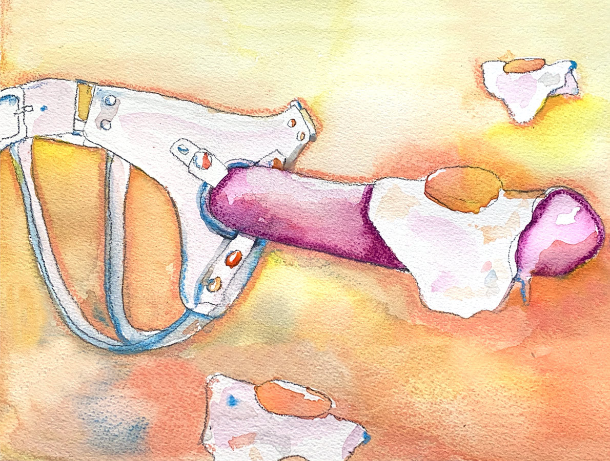What is Pegging?